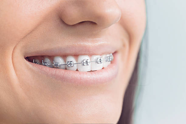 Best Dental Fillings (Composite and Amalgam)  in Marion, MS